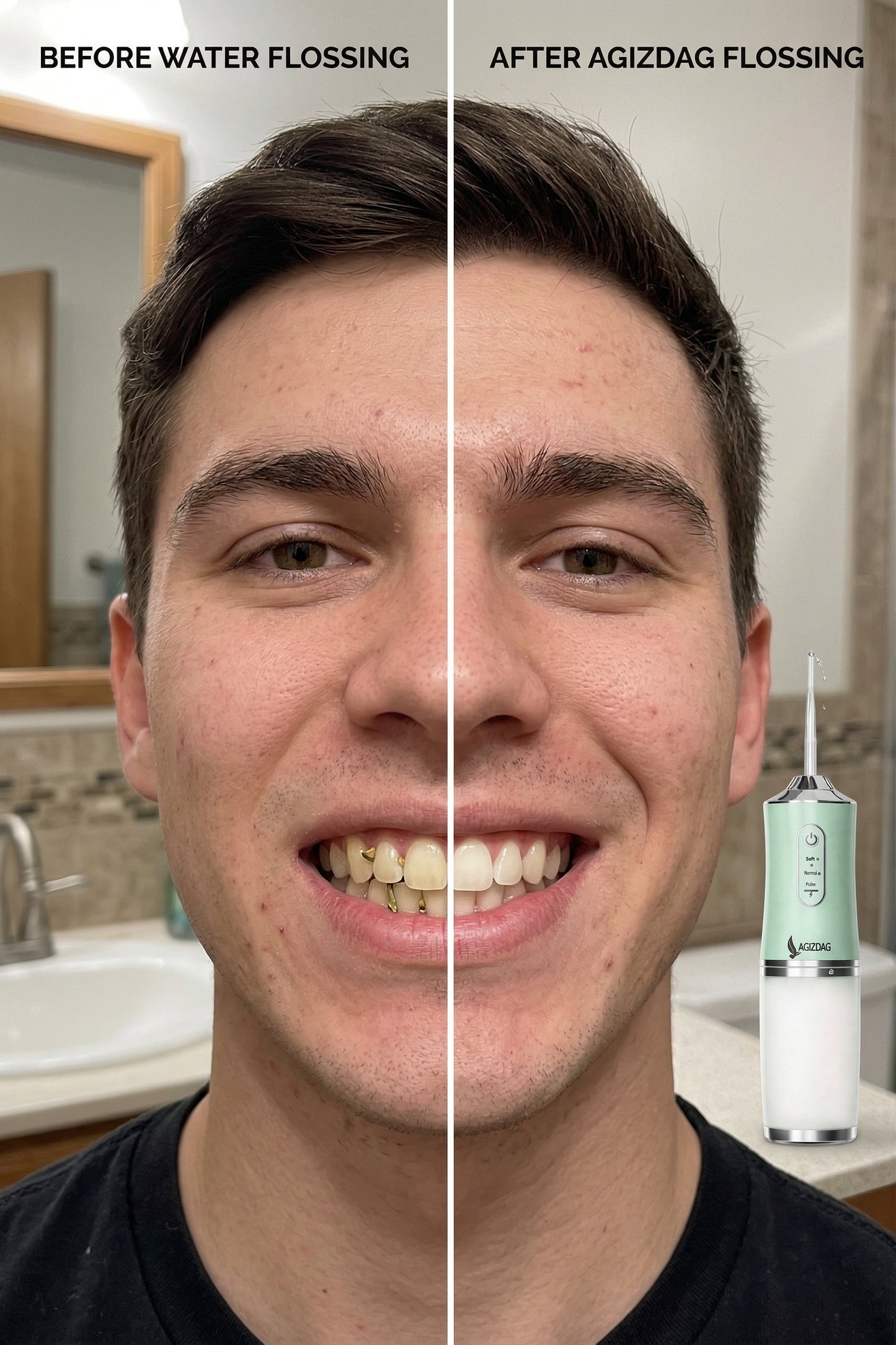 Irrigador Dental ProClean – Limpieza Profunda Sin Dentista